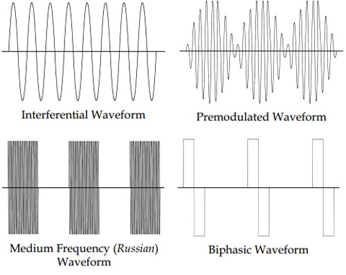 Types of Electrical Stimulation in Physical Therapy