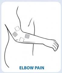 TENs Electrode Placement for Elbow Pain