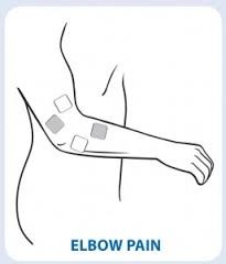 TENs Electrode Placement for Elbow Pain