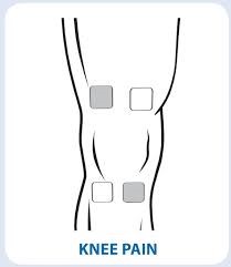 TENs Electrode Placement for Knee Pain