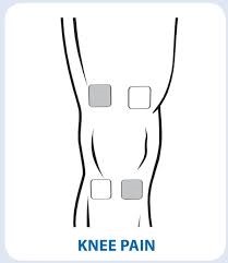 Electrode Placement For Electrical Stimulation Chart